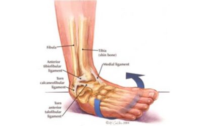A Guide to AFL Football Injury Prevention & How Podiatry Can Help You